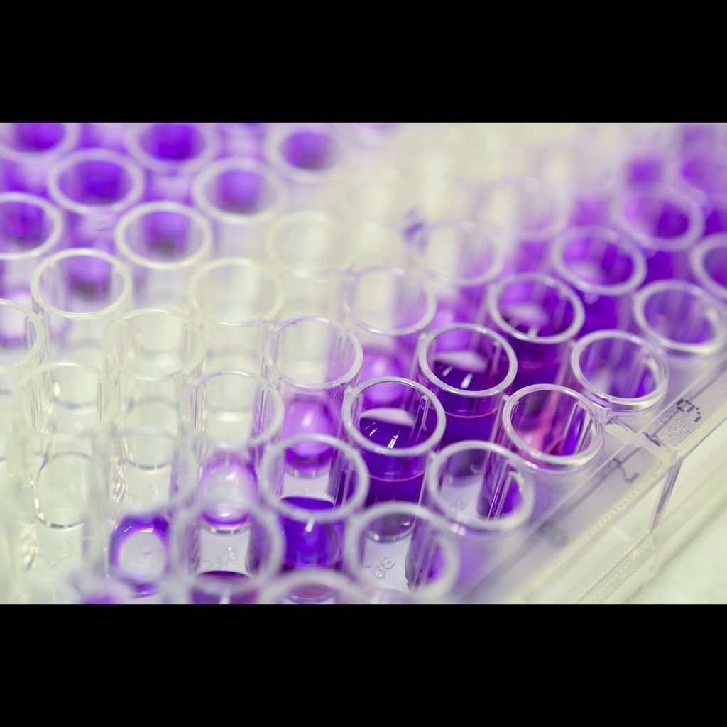 APLNR elisa kit :: Human Apelin receptor, APLNR ELISA Kit size: 96size:Stripsize:Well